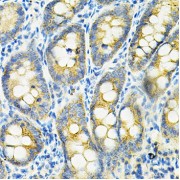 Immunohistochemistry of paraffin-embedded Rat intestine using HGF Antibody (1/100 dilution, 40x lens).