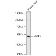 Western blot analysis of extracts of Mouse heart using MMP3 Antibody (1/1000 dilution).