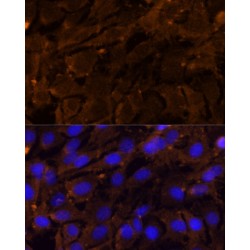 Matrix Metalloproteinase 3 / Stromelysin-1 (MMP3) Antibody