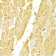 Immunohistochemistry of paraffin-embedded Rat heart using CA3 Antibody (1/100 dilution, 40x lens).