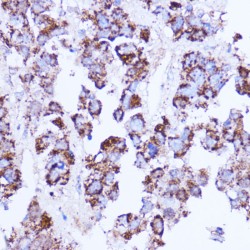 Serine Hydroxymethyltransferase, Mitochondrial (SHMT2) Antibody