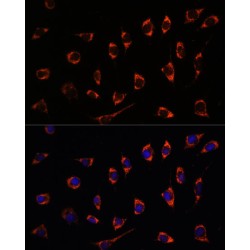 Serine Hydroxymethyltransferase, Mitochondrial (SHMT2) Antibody