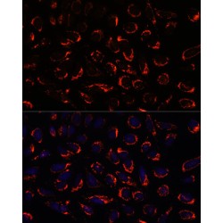 Serine Hydroxymethyltransferase, Mitochondrial (SHMT2) Antibody