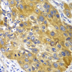 Adenylate Kinase 1 (AK1) Antibody