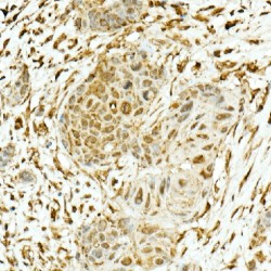 Nuclear Factor, Erythroid Derived 2 Like 2 (NFE2L2) Antibody