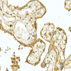 Nuclear Factor, Erythroid Derived 2 Like 2 (NFE2L2) Antibody