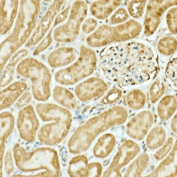 Nuclear Factor, Erythroid Derived 2 Like 2 (NFE2L2) Antibody