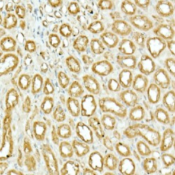 Nuclear Factor, Erythroid Derived 2 Like 2 (NFE2L2) Antibody