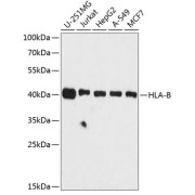 Western blot analysis of extracts of various cell lines using HLA-B Antibody (1/3000 dilution).