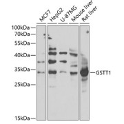 Western blot analysis of extracts of various cell lines using GSTT1 Antibody (1/1000 dilution).