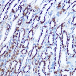 Superoxide Dismutase 2 (SOD2) Antibody