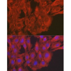 Superoxide Dismutase 2 (SOD2) Antibody