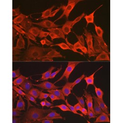 Superoxide Dismutase 2 (SOD2) Antibody