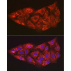 Superoxide Dismutase 2 (SOD2) Antibody