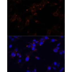 CD44 Antigen (CD44) Antibody