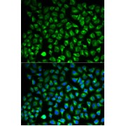 Immunofluorescence analysis of HeLa cells using MAOA Antibody