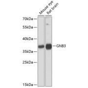 Western blot analysis of extracts of various cell lines using GNB3 Antibody (1/1000 dilution).