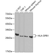 Western blot analysis of extracts of various cell lines using HLA-DPB1 Antibody (1/1000 dilution).