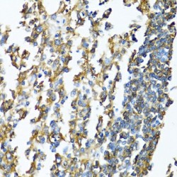 HLA Class II Histocompatibility Antigen, DP Beta 1 Chain (HLA-DPB1) Antibody