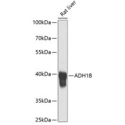 Western blot analysis of extracts of Rat liver using ADH1B Antibody (1/1000 dilution).