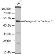 Western blot analysis of extracts of ES-2 cells using Coagulation Protein C Antibody (1/1000 dilution).