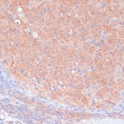 Immunohistochemistry of paraffin-embedded Rat ovary using LRP1 Antibody (1/100 dilution, 40x lens).