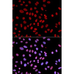 Protein Tyrosine Phosphatase, Non-Receptor Type 6 (PTPN6) Antibody