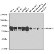 Western blot analysis of extracts of various cell lines using RPS6KB2 Antibody (1/1000 dilution).