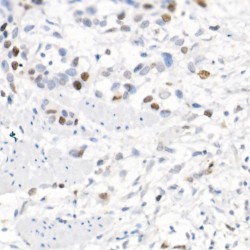 Baculoviral IAP Repeat-Containing Protein 5 (BIRC5) Antibody