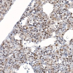 Baculoviral IAP Repeat-Containing Protein 5 (BIRC5) Antibody