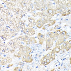 Haptoglobin / Zonulin Proprotein (HP) Antibody