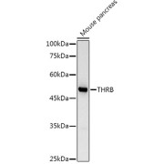 Western blot analysis of extracts of Mouse pancreas using TRβ1/THRB Antibody (1/1000 dilution).