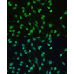 Nuclear Receptor Subfamily 1 Group I Member 2 (NR1I2) Antibody