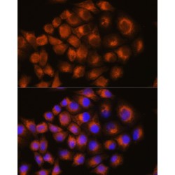 Adenosine A2a Receptor (ADORA2A) Antibody