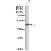 Western blot analysis of extracts of Jurkat cells using ETS1 Antibody (1/1000 dilution).