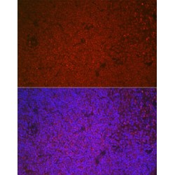 Protein C-Ets-1 (ETS1) Antibody