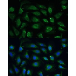 SPARC (SPARC) Antibody