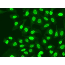 Replication Factor C Subunit 1 (RFC1) Antibody