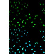 Immunofluorescence analysis of MCF-7 cells using RFC1 Antibody