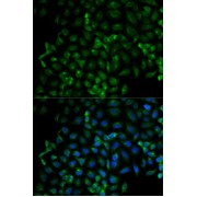 Immunofluorescence analysis of HeLa cells using Beta-TRCP Antibody