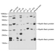 Western blot analysis of extracts of various cell lines using Myelin Basic protein Antibody (1/1000 dilution).