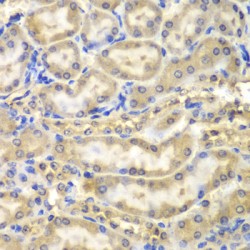 Myelin Basic Protein (MBP) Antibody