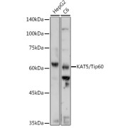 Western blot analysis of extracts of various cell lines using KAT5/Tip60 Antibody (1/500 dilution).