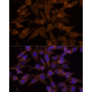 Immunofluorescence analysis of HeLa cells using UGT2B7 Antibody (1/100 dilution, 40x lens). Blue: DAPI for nuclear staining.