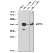 Western blot analysis of extracts of various cell lines using KIR2DL3 Antibody (1/1000 dilution).