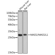 Western blot analysis of extracts of various cell lines using MAD2/MAD2/MAD2L1 Antibody (1/3000 dilution).