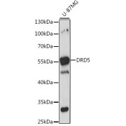 Western blot analysis of extracts of U-87MG cells using DRD5 Antibody (1/1000 dilution).