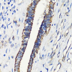 FK506 Binding Protein 1A (FKBP1A) Antibody