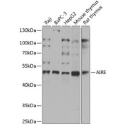 Western blot analysis of extracts of various cell lines using AIRE Antibody (1/1000 dilution).