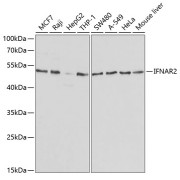 Western blot analysis of extracts of various cell lines using IFNAR2 Antibody (1/1000 dilution).